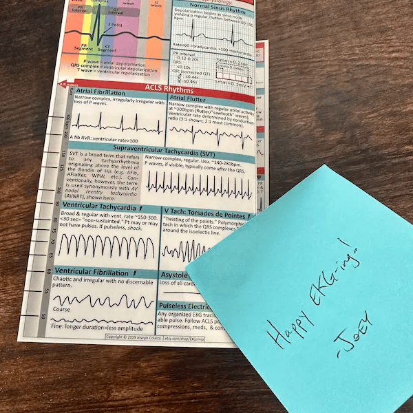 EKG Pocket Guide