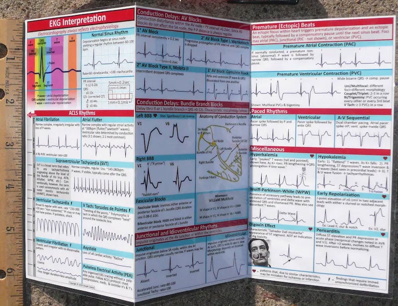 EKG Pocket Guide