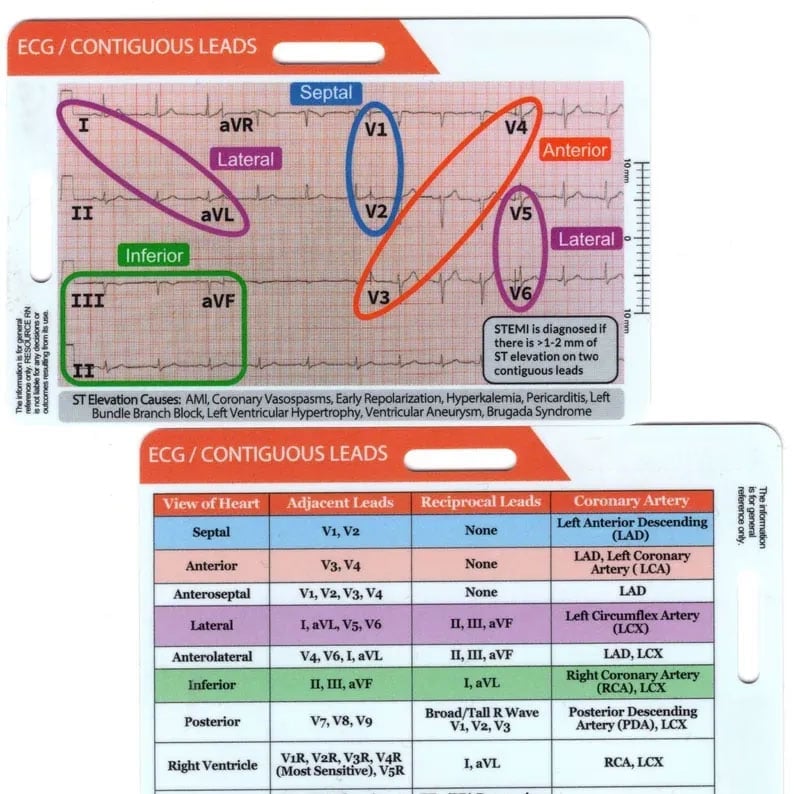 EKG Pocket Guide